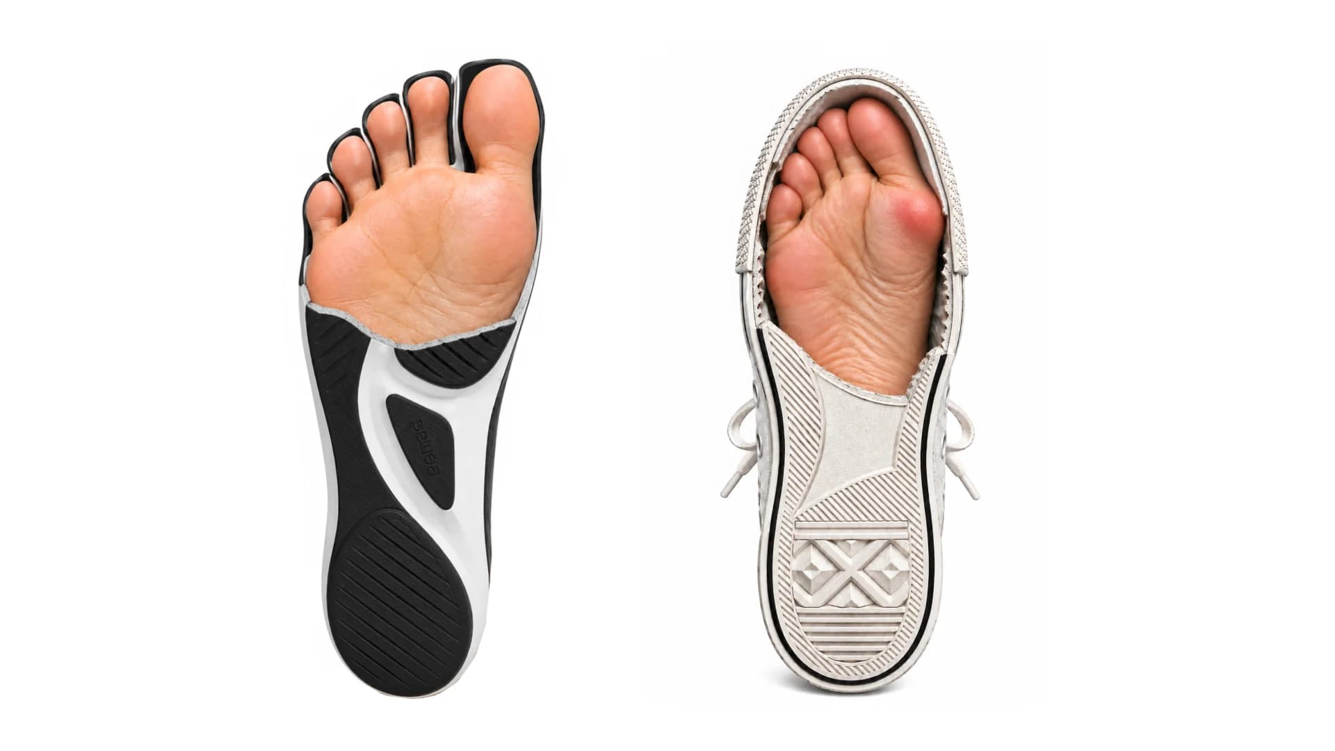 Side by side from below: a foot with all five toes spread in a Peluva five-toe sole, next to a foot squeezed into a conventional sneaker with a red bunion at the big-toe joint