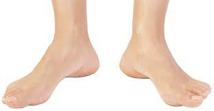 Is-It-Okay-To-Walk-Duck-Footed peluva